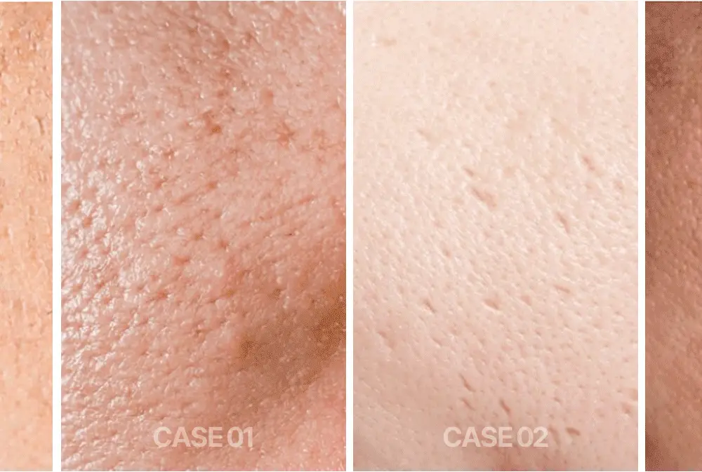 [모공샷앰플] 웰라쥬 하이퍼 펩타이드 보툴리들 앰플 50ml 상세페이지 6
